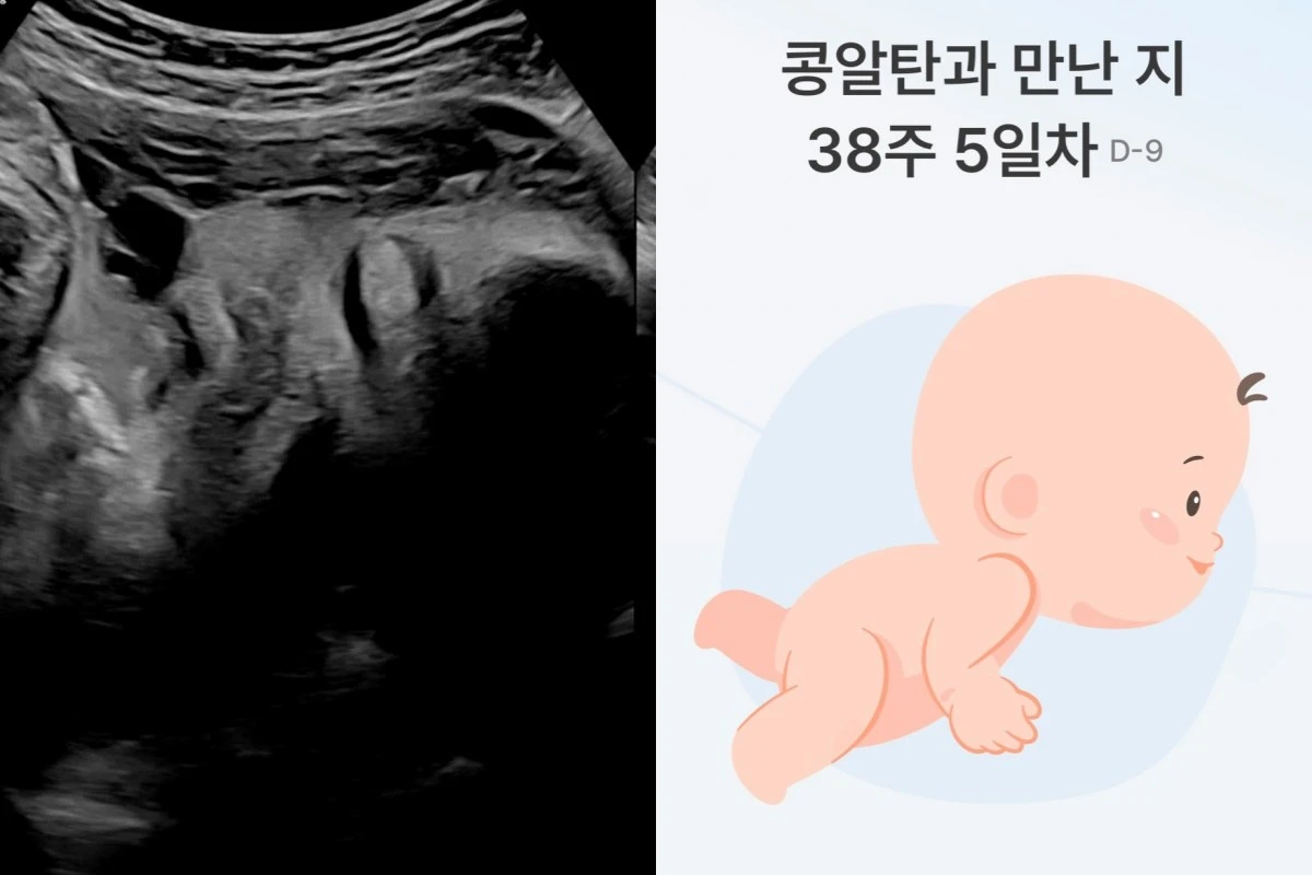 남보라 계정
