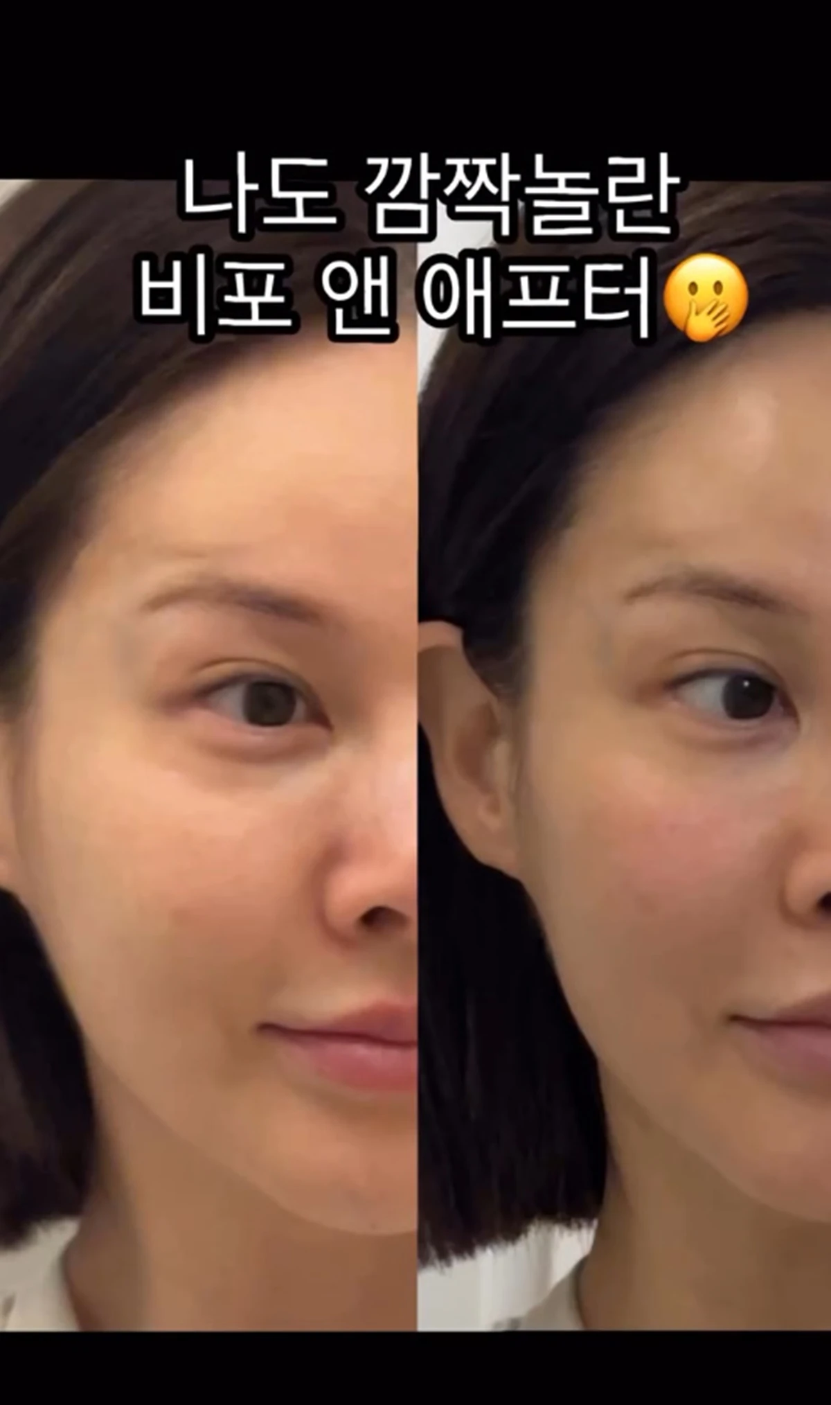 아이비 계정