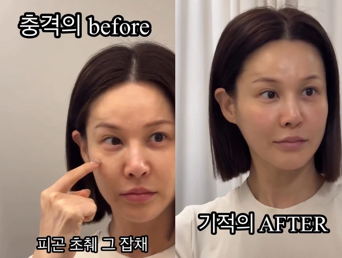 아이비 계정