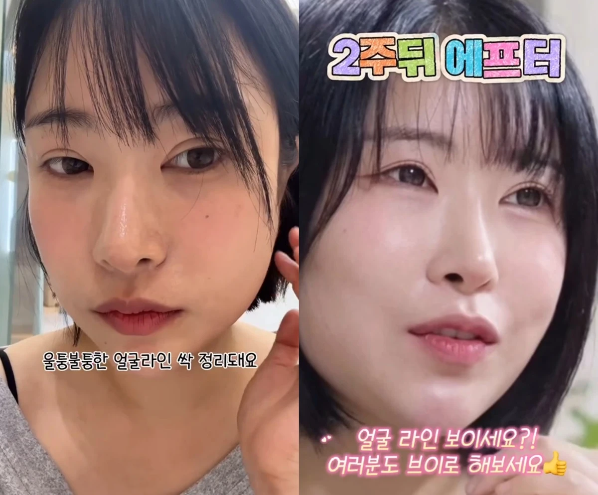 이세영 계정