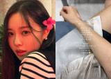 '암투병' 이솔이, 안타까운 근황…또 병원 찾았다 "오른쪽 팔목 남아나질 않아" [★해시태그] 