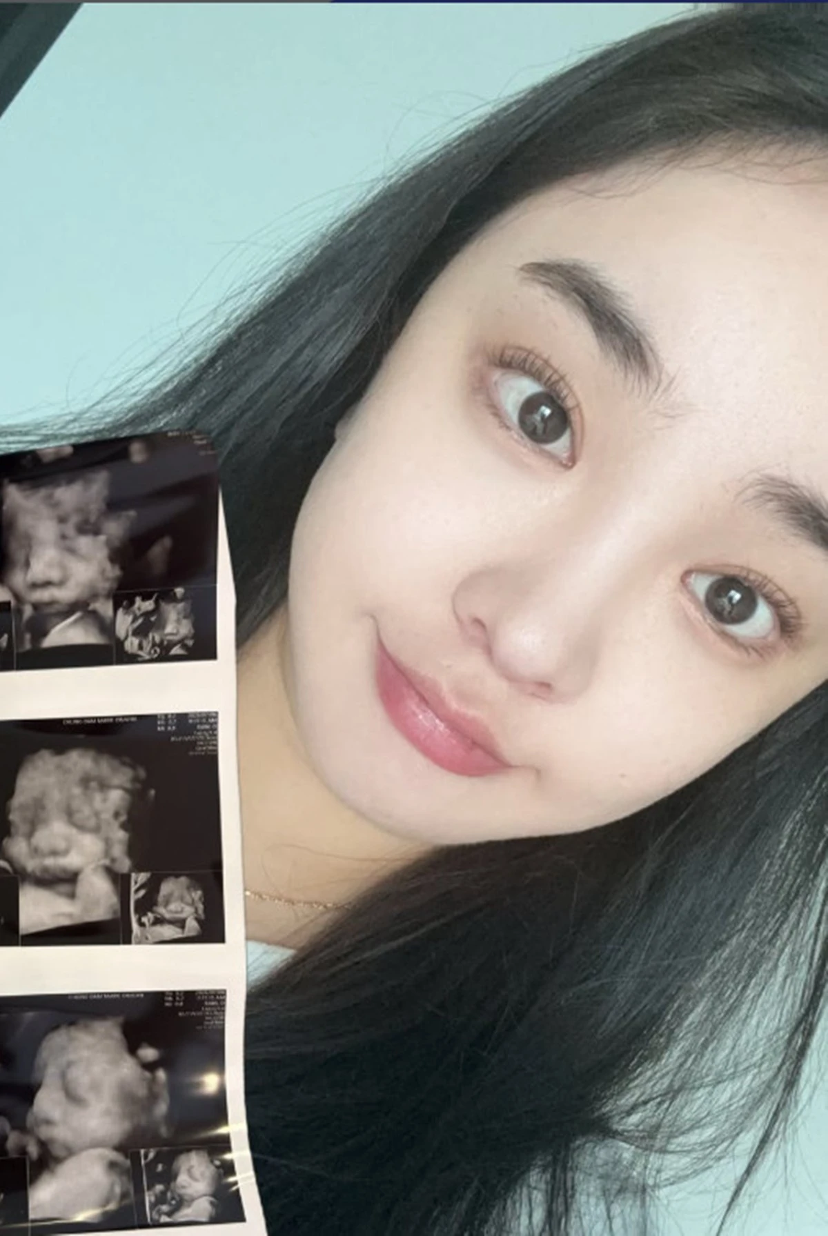 사진 = 나현 SNS
