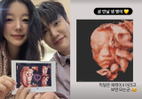 '8월 출산' 문지인, ♥김기리 유전자 몰빵 됐나…벌써 돋보이는 '두꺼운 입술' [★해시태그]