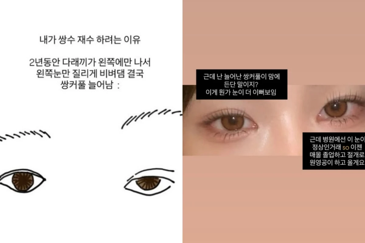 (엑스포츠뉴스 윤재연 기자) 故 최진실의 딸 최준희가 눈 재수술을 선택한 이유를 솔직히 고백했다. 23일 최준희는 자신의 계정 스토리에