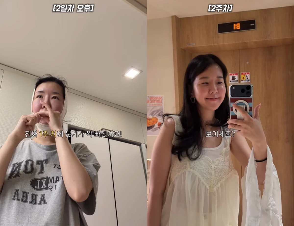 김지혜 SNS