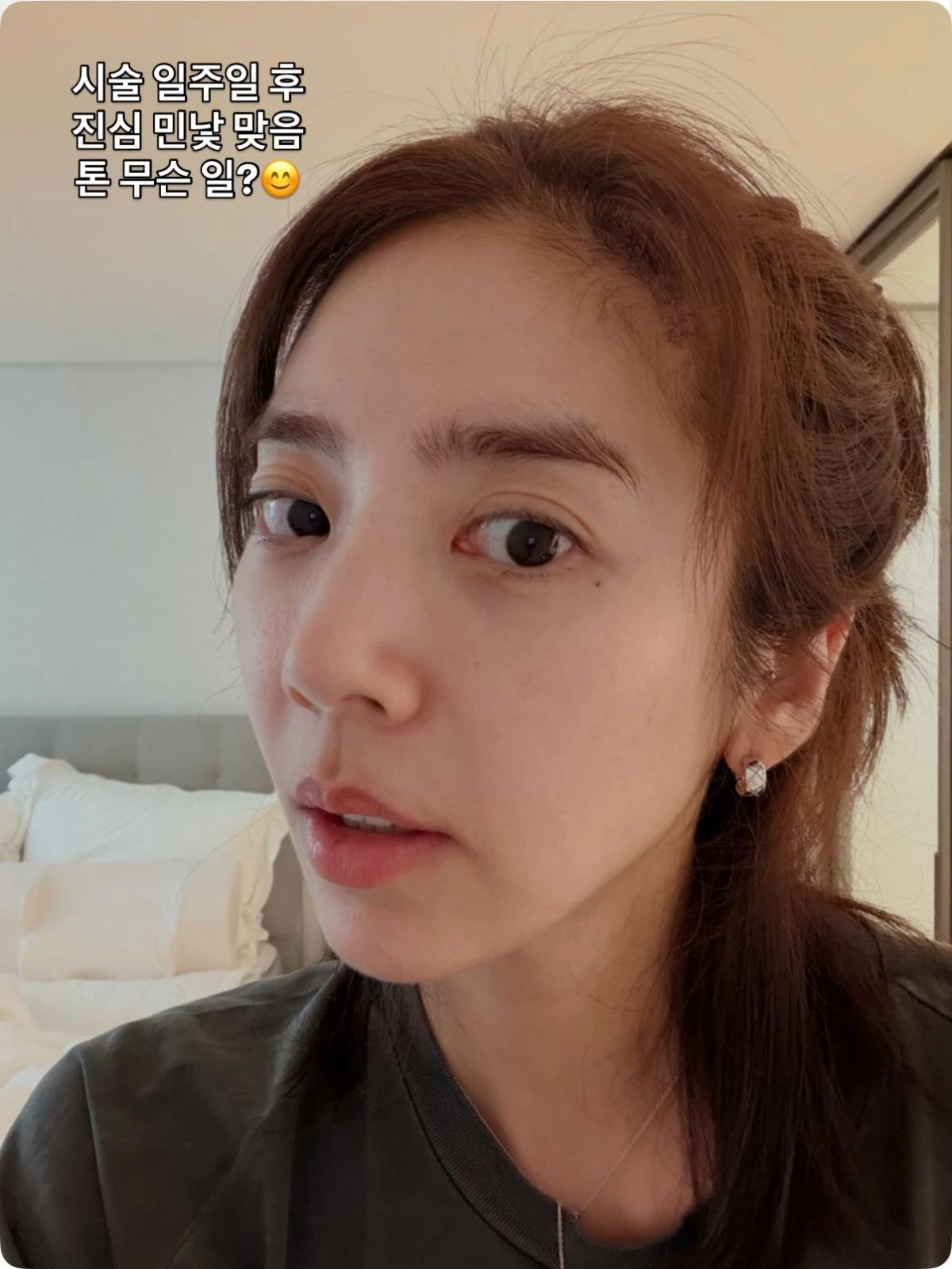 손담비, 시술 후기