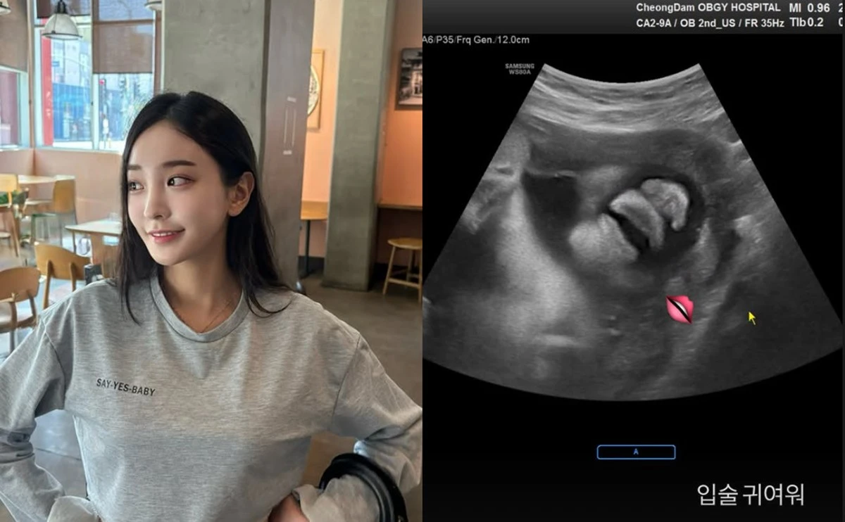 사진 = 나현 계정