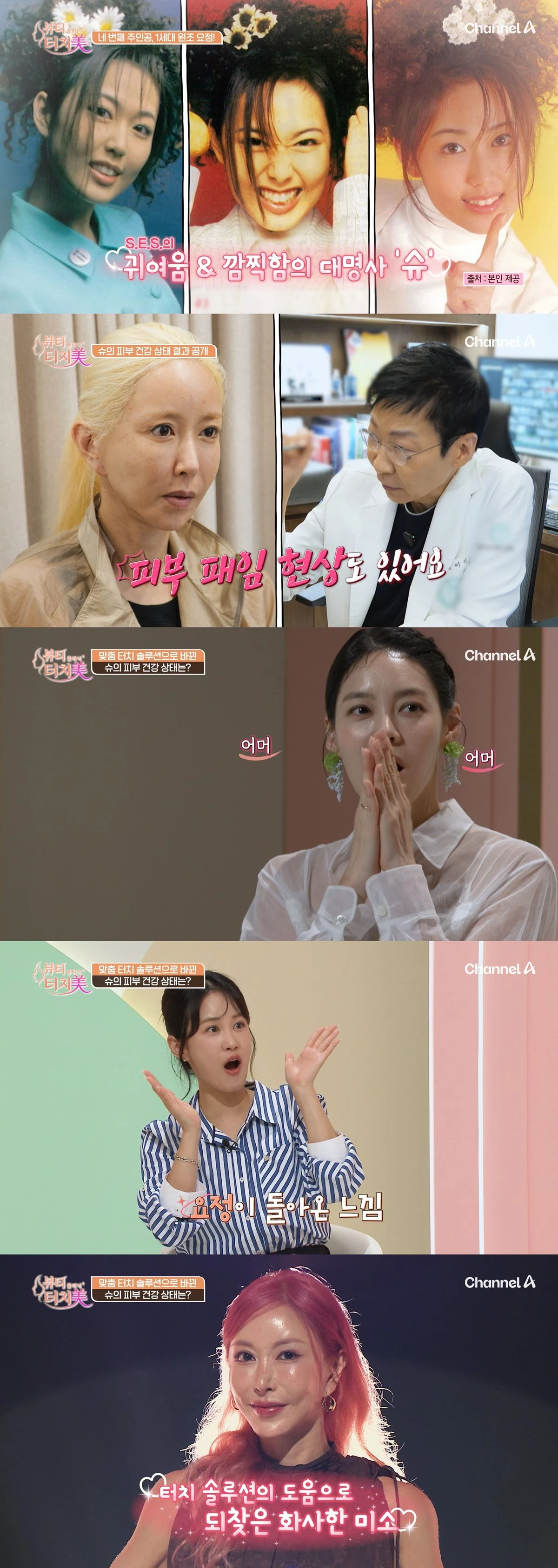 채널A '뷰티 클리닉 터치미' 4회