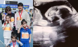 박주호♥안나, 넷째 임신이 '무책임'? 섣부른 걱정보단 축하를 [엑's 이슈]