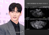 홍민기 전 여친, 초음파 사진 공개 초강수…"관계 중 폭력 2~3회" 폭로는 계속 