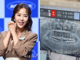 신지, '양악 루머'에 개구장애·엑스레이 다 깠다..."마음고생 그만" 응원 물결 [엑's 이슈]