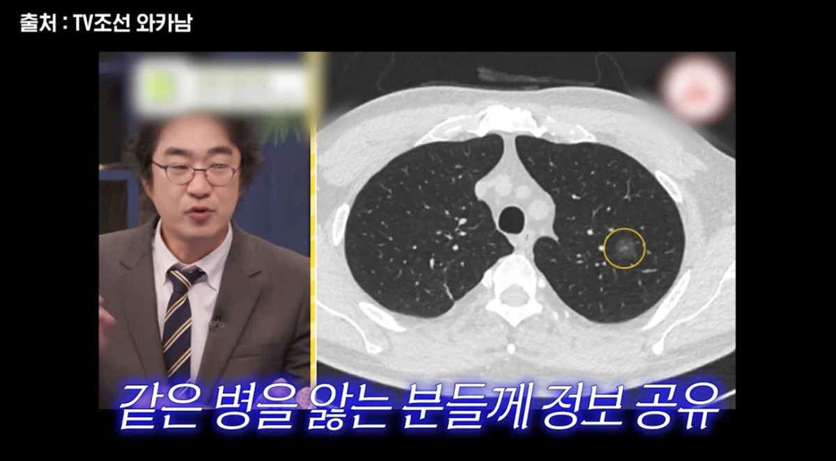 유튜브 채널 'A급 장영란'