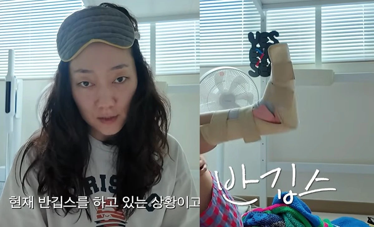 배우 박경혜, 발목 인대 파열로 반깁스 착용