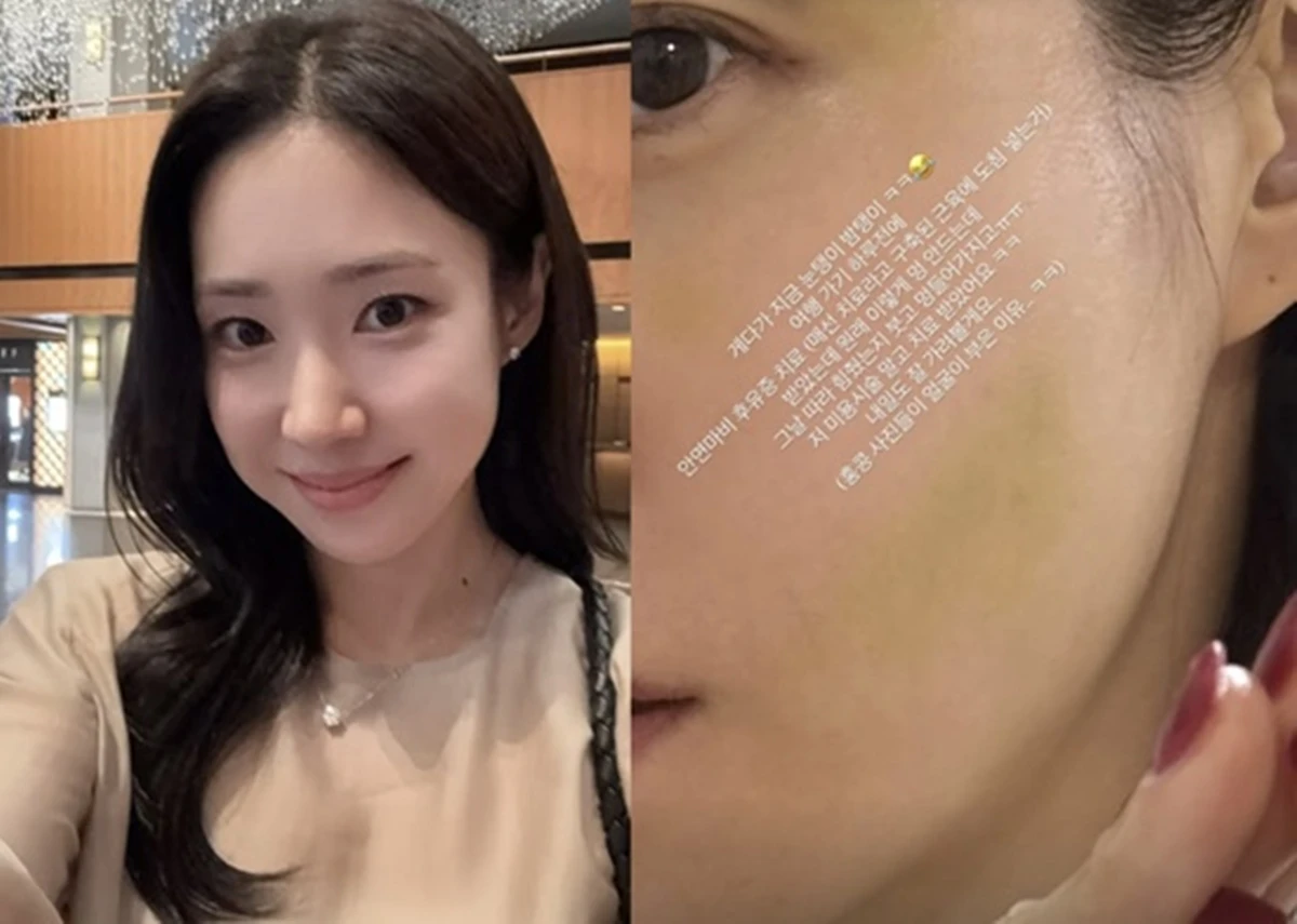최희 SNS