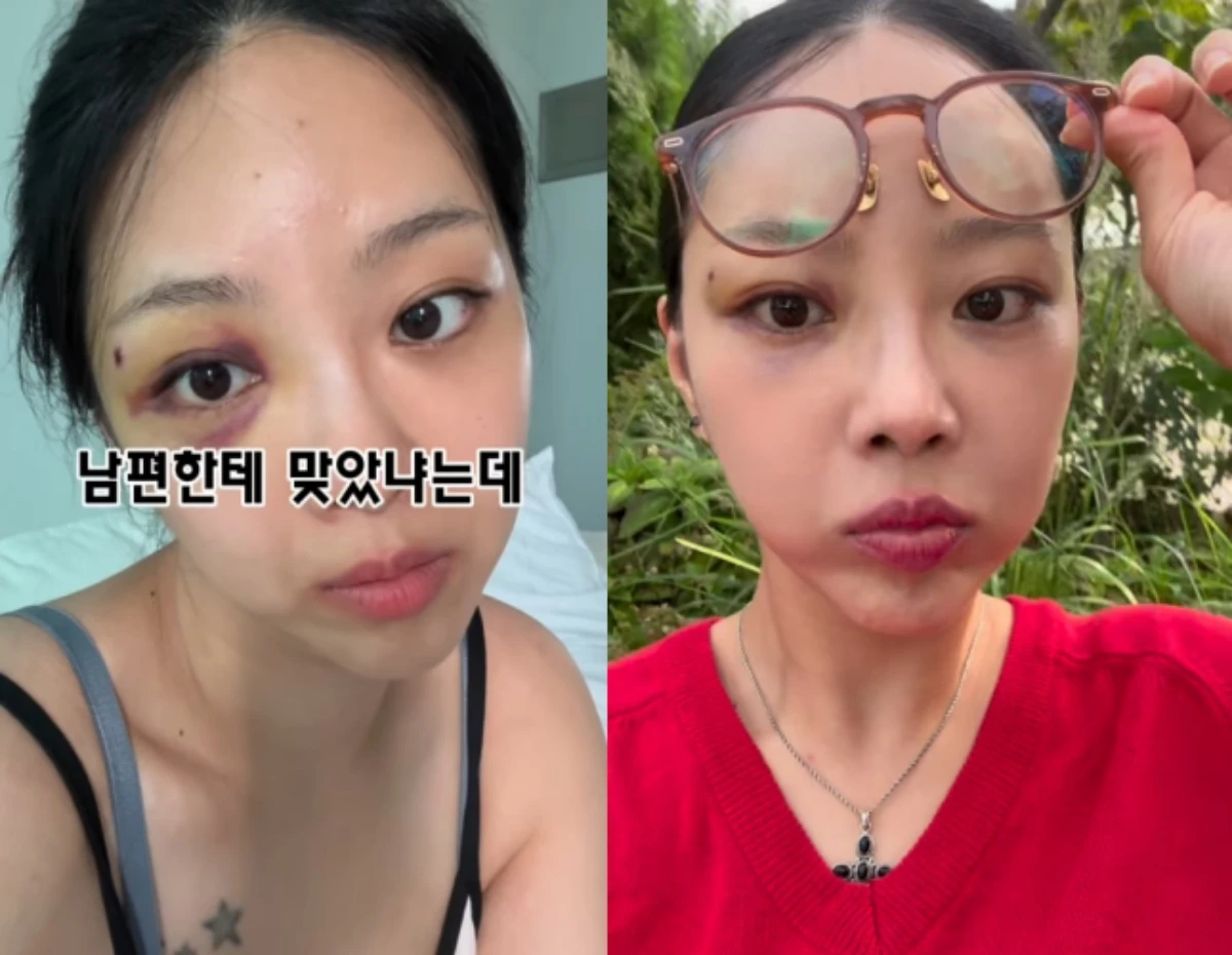 10기 옥순 SNS.