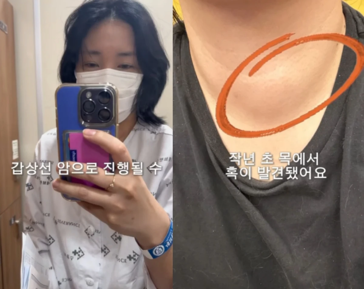 허안나 SNS.