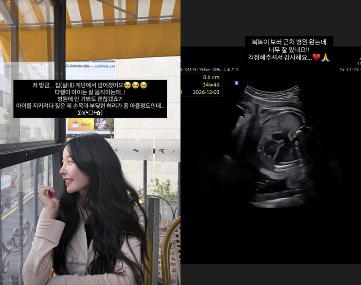 아야네 SNS