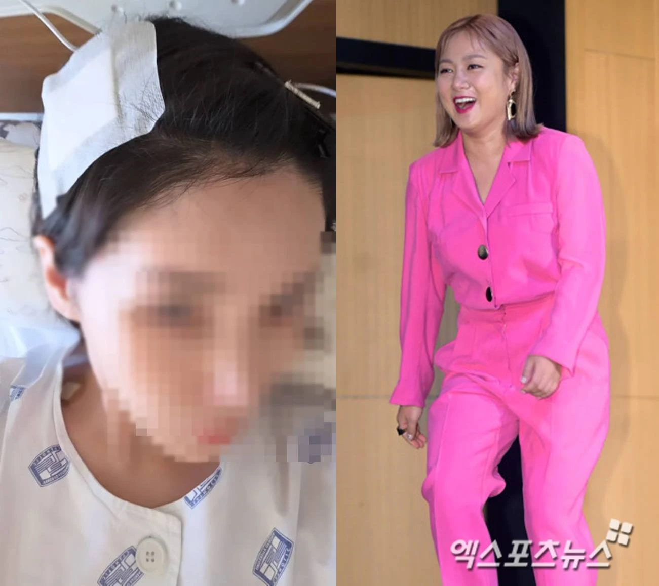 주사이모 계정, 엑스포츠뉴스DB